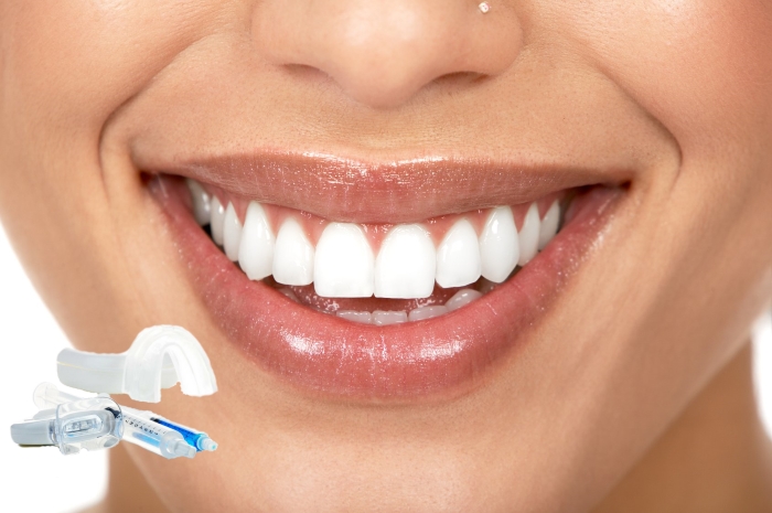 Преимущества набора SmileFactor (СмайлФактор) для отбеливания зубов
