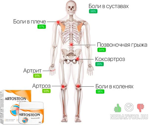 проблемы с суставами