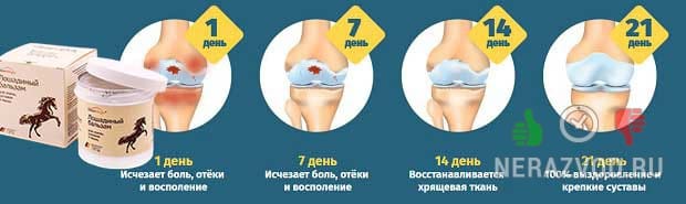 запущенный артроз
