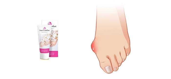 Foot Comfort от косточки на большом пальце: здоровые красивые ноги без врачей и операций!