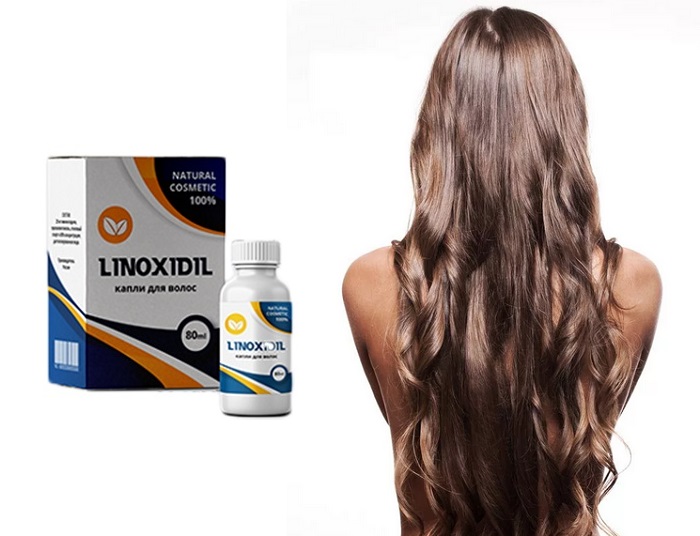 Linoxidil для роста волос: чтобы локоны всегда радовали вас своим внешним видом!