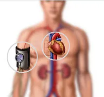 Огнёвка Мумиё показана при воспалении слизистой и атрофических процессах в желудке