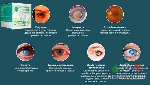 Проблемы со зрением