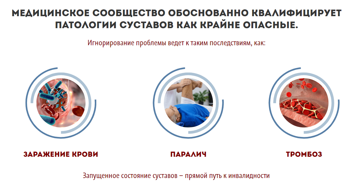 Последствия артрита Последствия артрита
