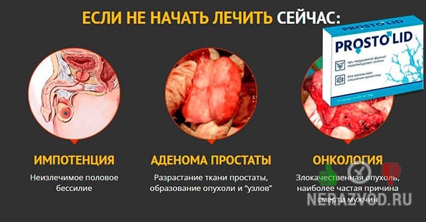 Prostolid от простатита
