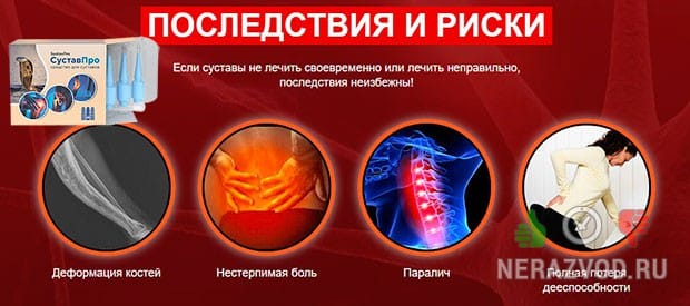 больные суставы